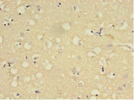 YWHAE / 14-3-3 Epsilon Antibody