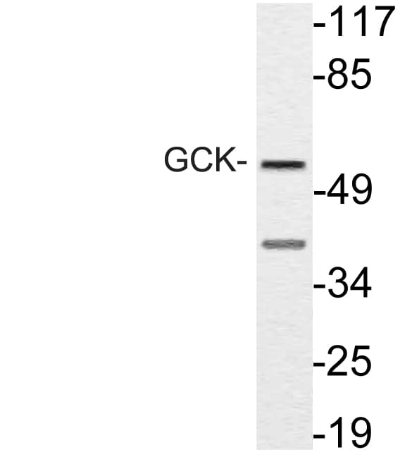 GCK / Glucokinase Antibody (aa43-92)