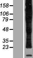 PLP1 / Myelin PLP Protein (Over-Expression Lysate Myc-DDK (Flag))