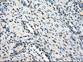 AKR1A1 Antibody (clone OTI2E7)