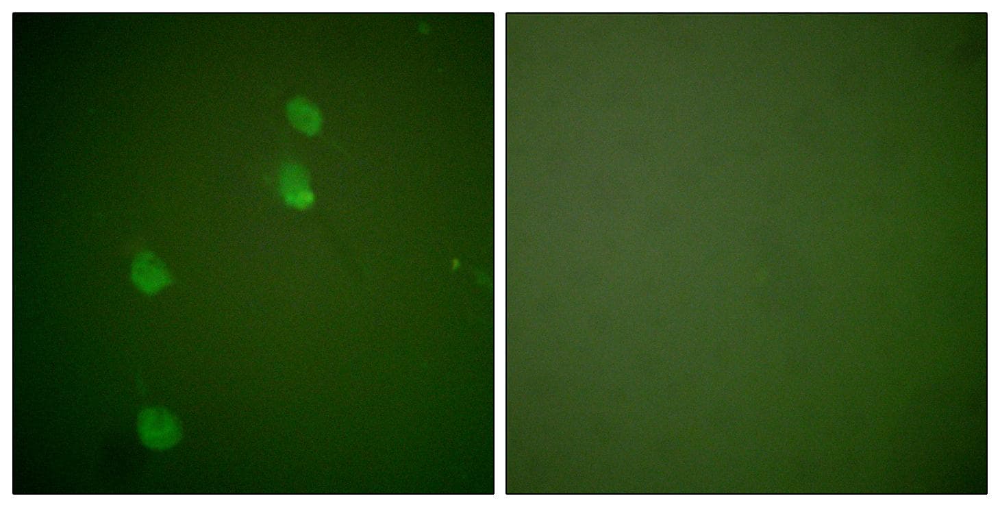 CUL2 / Cullin 2 Antibody
