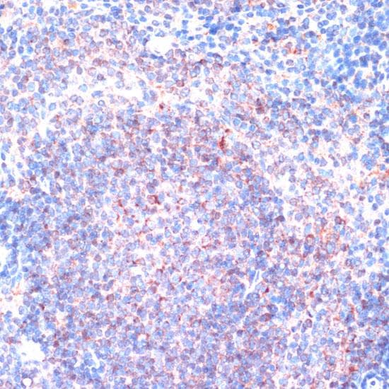 RPS6KA1 / RSK1 Antibody