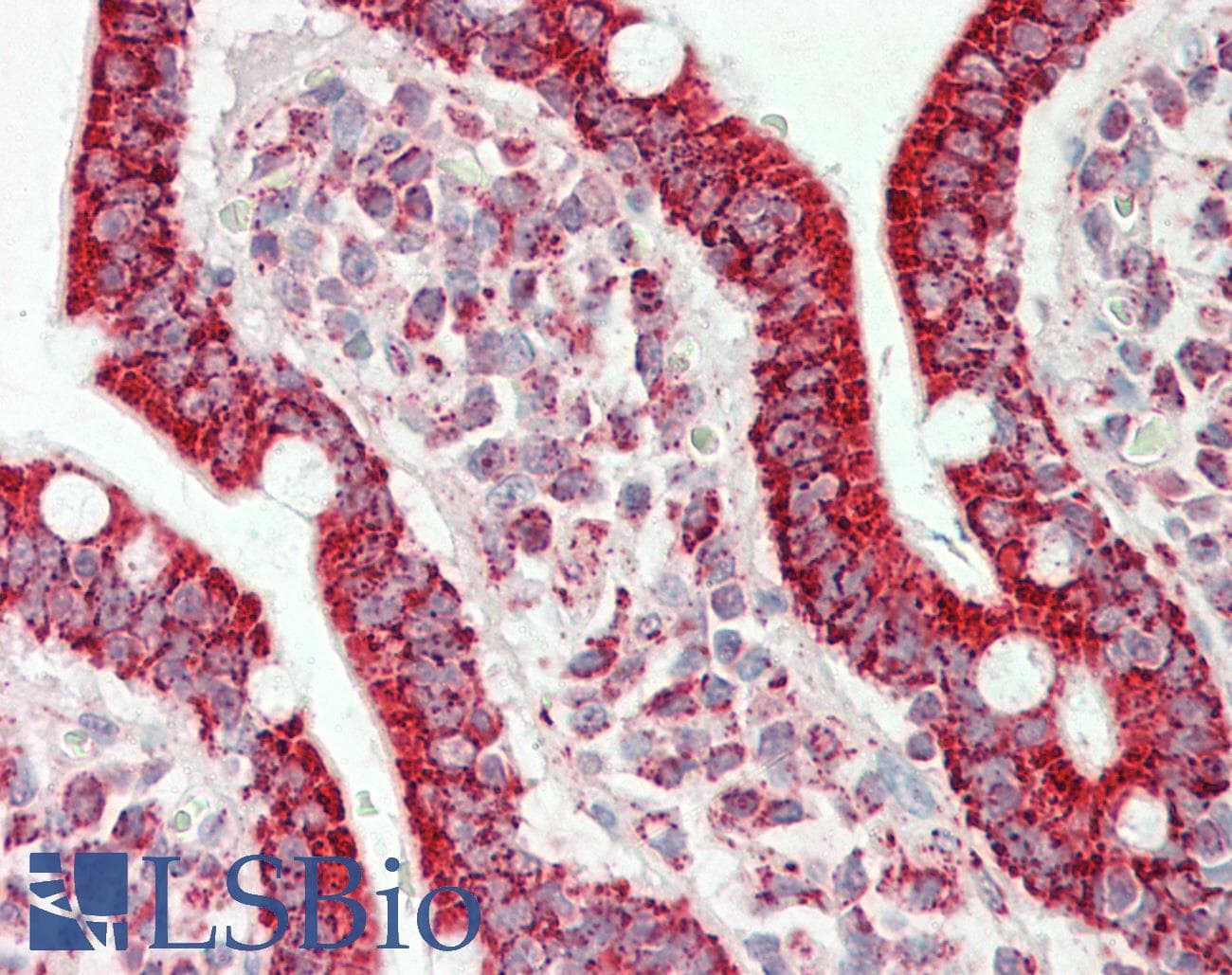 IHC-plus™ Polyclonal Goat anti-Human ATP5A1 / ATP Synthase Alpha Antibody (aa83-94, IHC, WB)