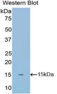 AMH / Anti-Mullerian Hormone Antibody (aa453-560)