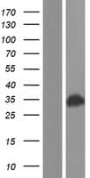Human CDV3 Protein (Over-Expression Lysate Myc-DDK (Flag))