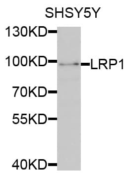 Polyclonal Rabbit anti-Human LRP1 / CD91 Antibody (aa20-270, IHC, IF, WB)