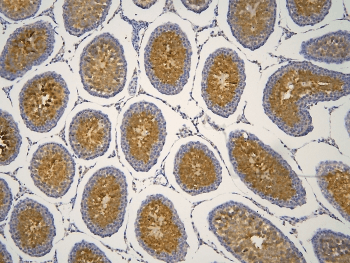 HOOK2 Antibody