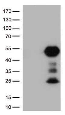 Monoclonal Mouse anti-Human CD32A Antibody (clone UMAB59, IHC, WB)