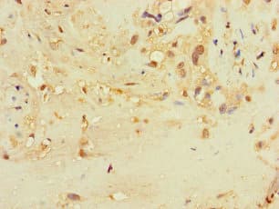 TSPAN32 / PHEMX Antibody
