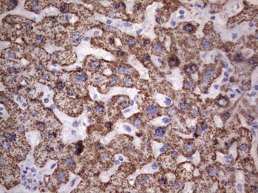 PIK3CD / PI3K Delta Antibody (aa286-610, clone OTI1D11)