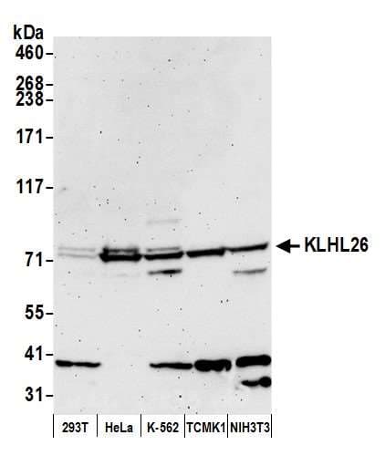 Polyclonal Rabbit anti-Human KLHL26 Antibody (aa565-615, WB)