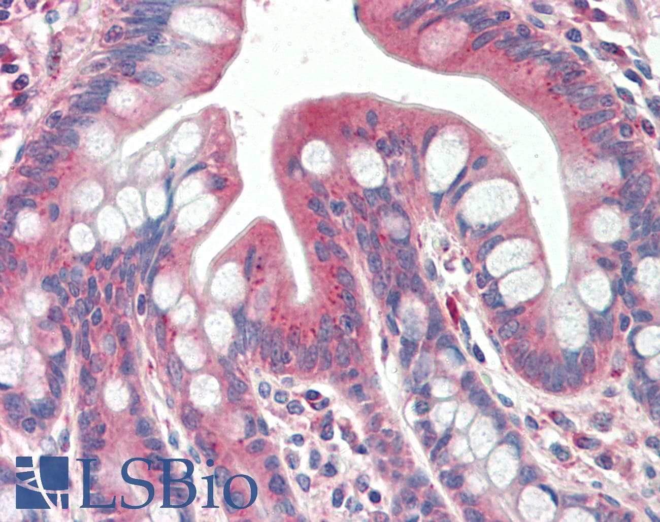 IHC-plus™ TXNDC11 Antibody (aa114-126)