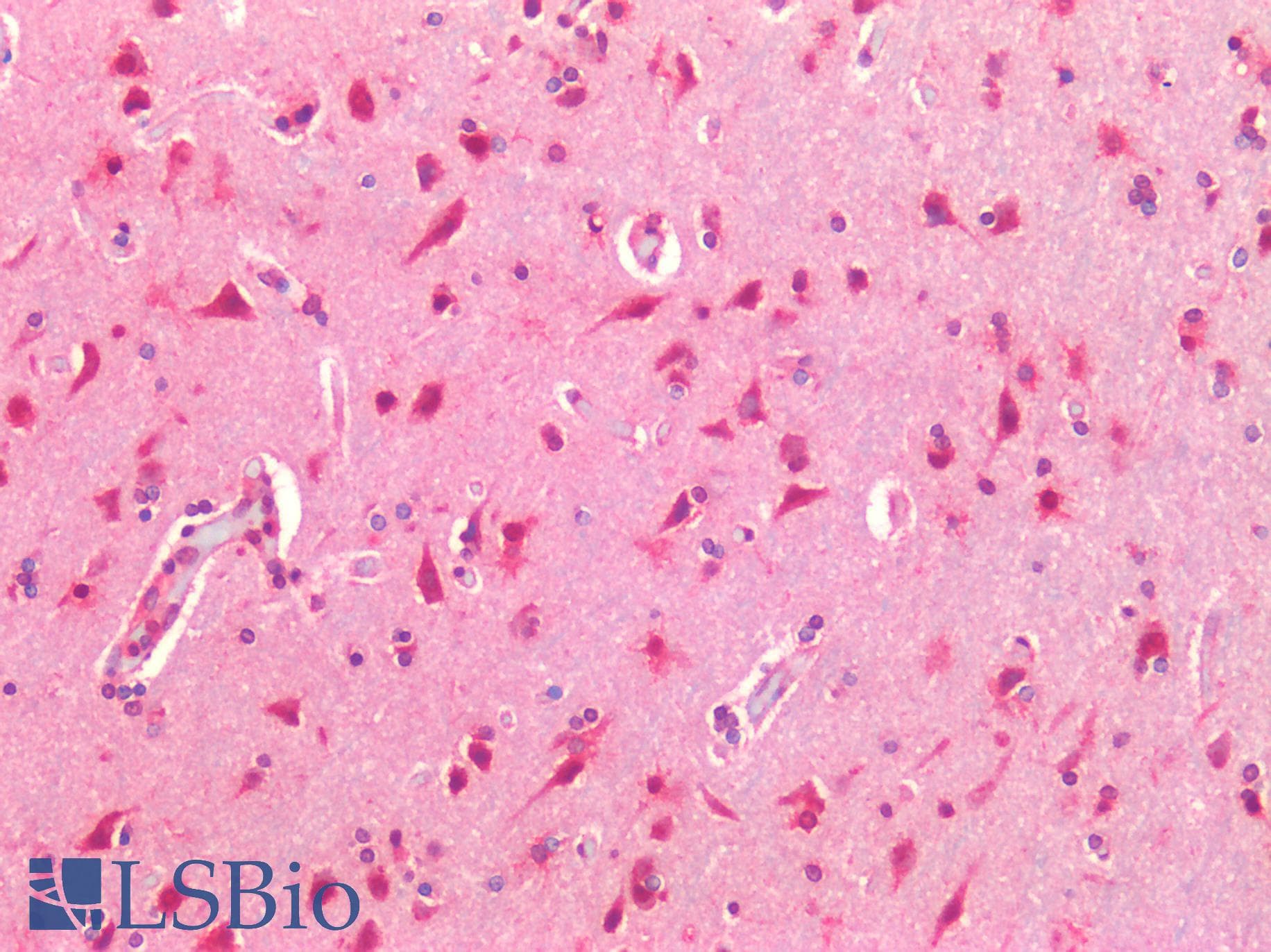 IHC-plus™ TM9SF4 Antibody (Internal)