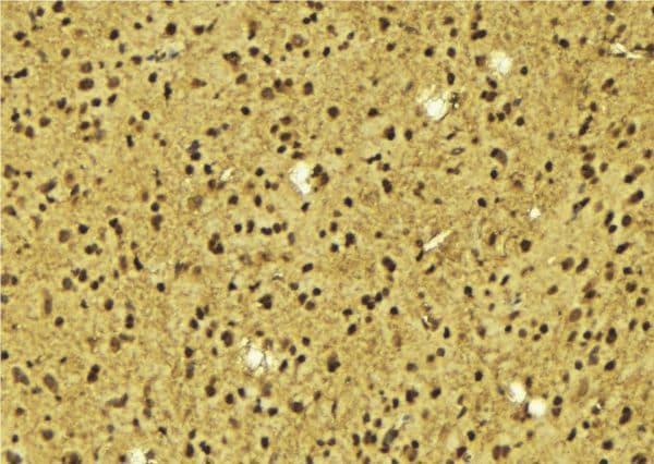 Polyclonal Rabbit anti-Human TIGD3 Antibody (IHC, IF, WB)