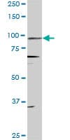 Monoclonal Mouse anti-Human PR / Progesterone Receptor Antibody (clone 4E9, IHC, IF, WB)