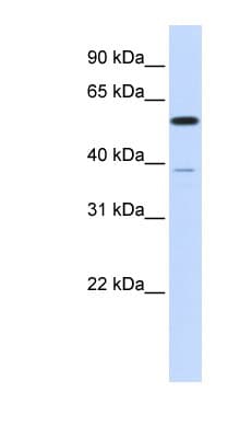 Polyclonal Rabbit anti-Human PPP2R5A Antibody (aa107-156, WB)