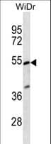 PIGV Antibody (aa343-371)