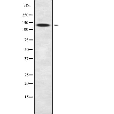 SLC9C2 / SLC9A11 Antibody