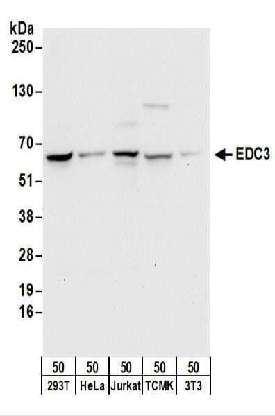 IHC-plus™ Polyclonal Rabbit anti-Human EDC3 Antibody (aa25-75, IHC, WB)