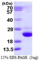 Human CFL2 / Cofilin 2 Protein (Recombinant His)