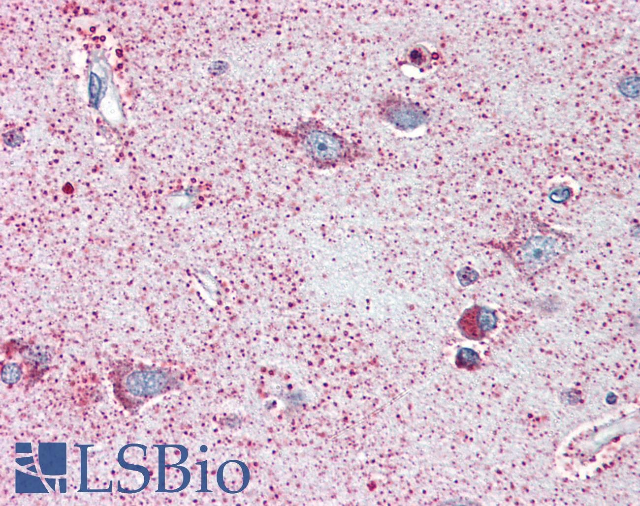 PathPlus™ NEK6 Antibody (N-Terminus)