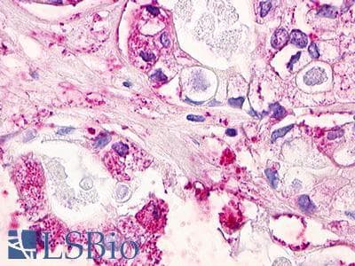 PathPlus™ MLNR/GPR38/Motilin Receptor Antibody (Internal)