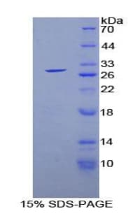 Human GSTA1 Protein (Recombinant His)