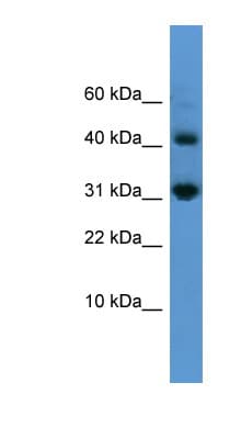 CASP7 / Caspase 7 Antibody (aa107-156)