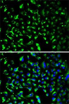 PHB / Prohibitin Antibody