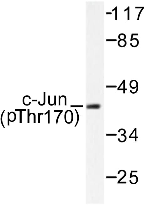 JUN / c-Jun Antibody (phospho-Tyr170)