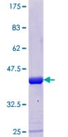 Human XTP4 / C17orf37 Protein (Recombinant GST)