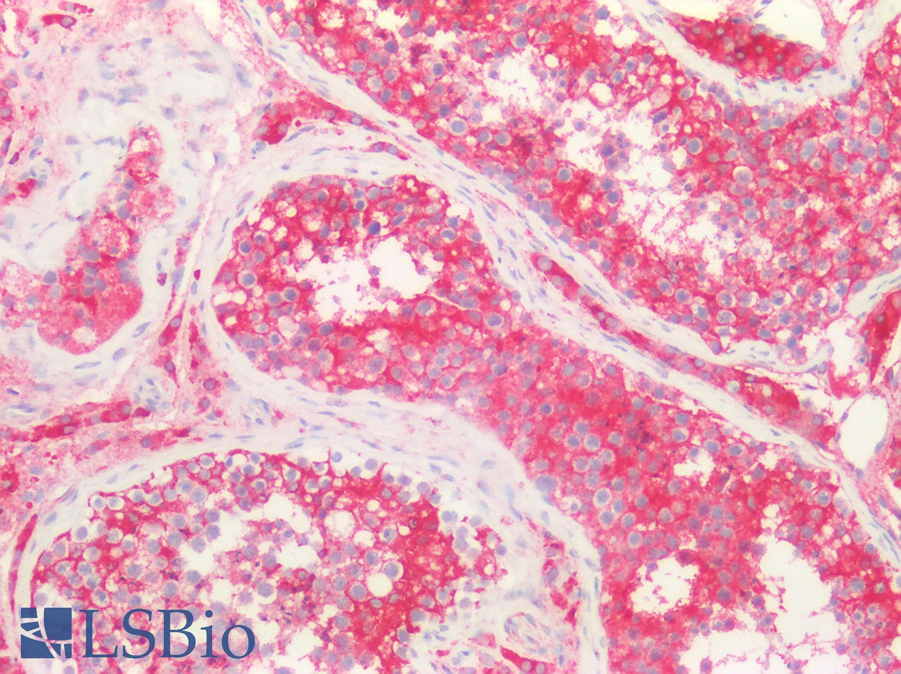 PathPlus™ MVP / VAULT1 Antibody (aa158-380)