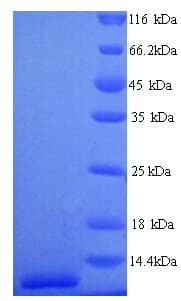 Human SFTPC / Surfactant Protein C (Recombinant His)