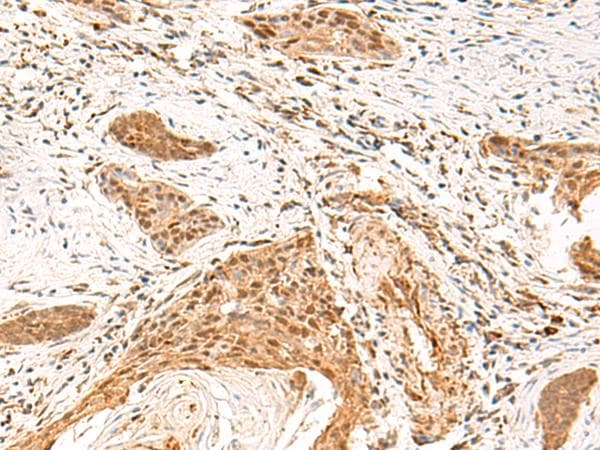TEAD3 Antibody