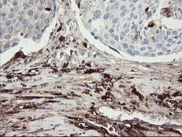F13A1 / Factor XIIIa Antibody (clone OTI3E3, Carrier-free)