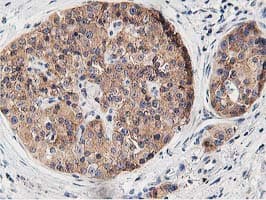 OSBP Antibody (clone OTI1F2)