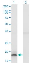 PEAK1 / SGK269 Antibody (clone 3F9)