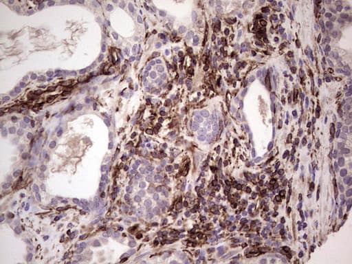 Peripherin Antibody (clone OTI1E10, Carrier-free)