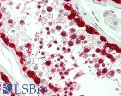 IHC-plus™ MAGEA4 Antibody (clone 1F9)