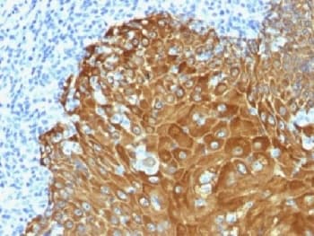 Pan Cytokeratin Antibody