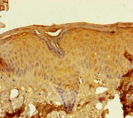LCE2A Antibody (aa1-106)