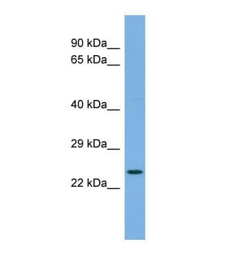 FAP Alpha Antibody (aa652-701)