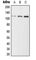 USP11 Antibody (Internal)