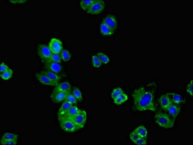 AGTR1 / AT1 Receptor Antibody