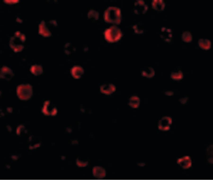 IRAK1 / IRAK Antibody