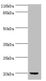 def / Peptide deformylase Antibody (aa2-169)