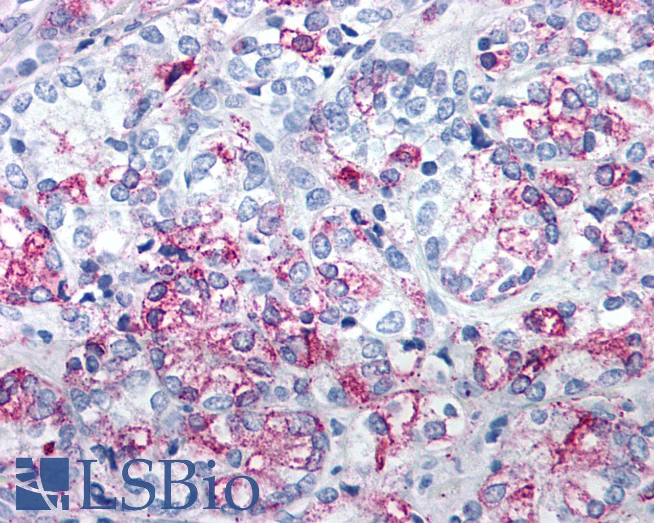 PathPlus™ Polyclonal Rabbit anti-Human VPAC2 / VIPR2 Antibody (C-Terminus, IHC)