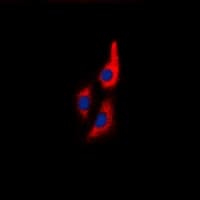 MLC2 / MYL9 Antibody (N-Terminus)