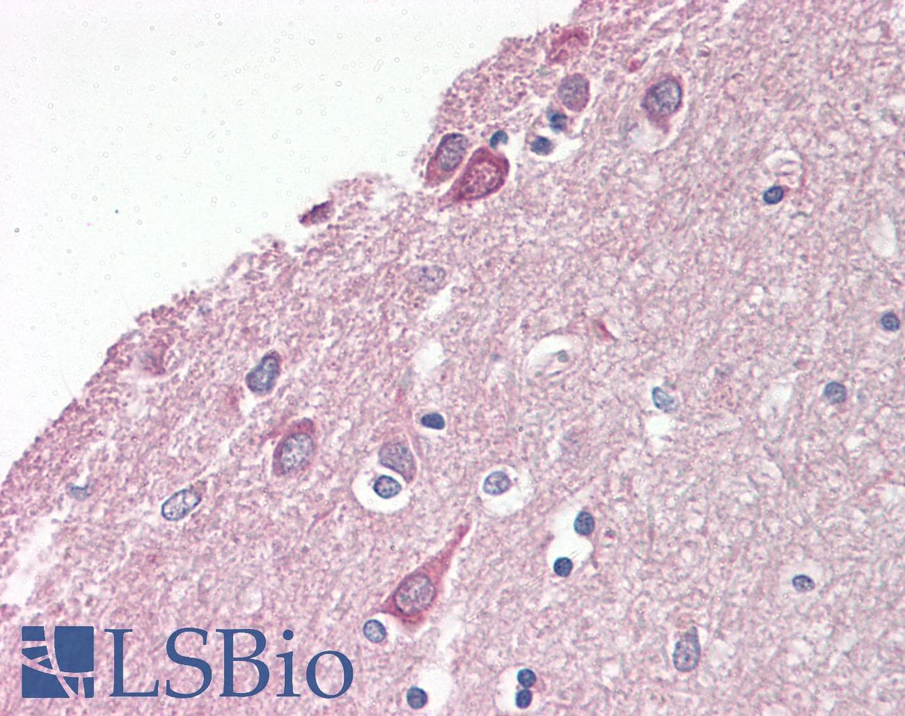PAFAH1B1 / LIS1 Antibody (N-Terminus)