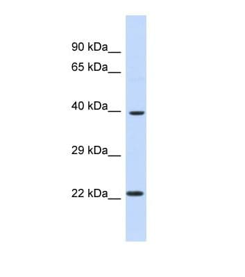 ARNT2 Antibody (aa20-69)